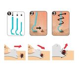 Bye Bugs - Starter Kit - Tick Removal